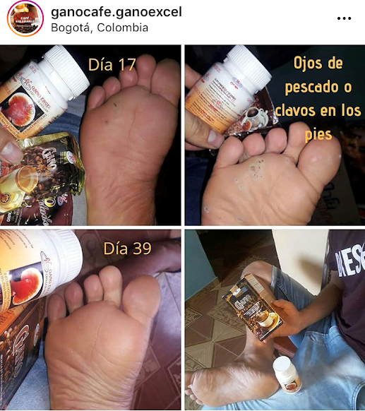 termektapasztalat_Kolumbia_Excellium_tyukszem